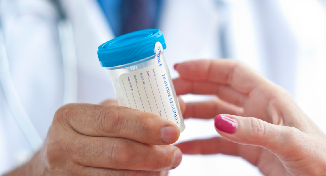 Drug and alcohol testing